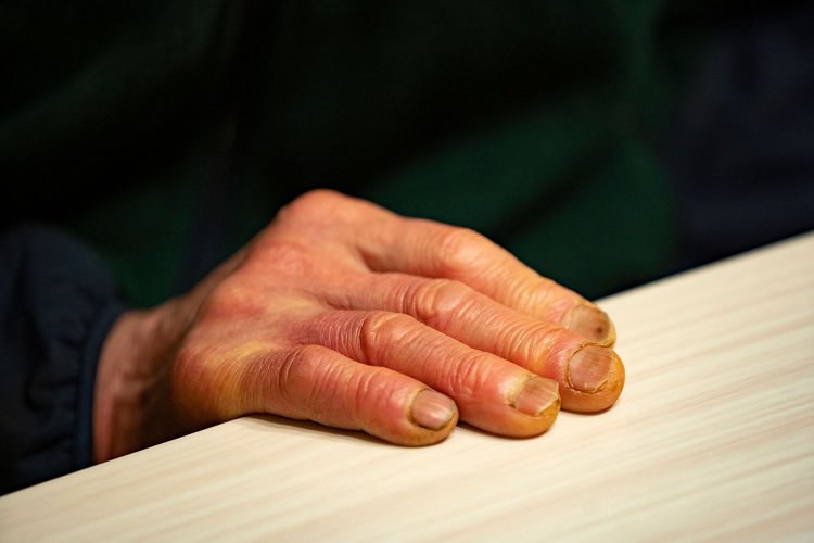 鍋割山の歴史を刻んできた手。実は海外遠征時に、凍傷で足の指を七本失っている。