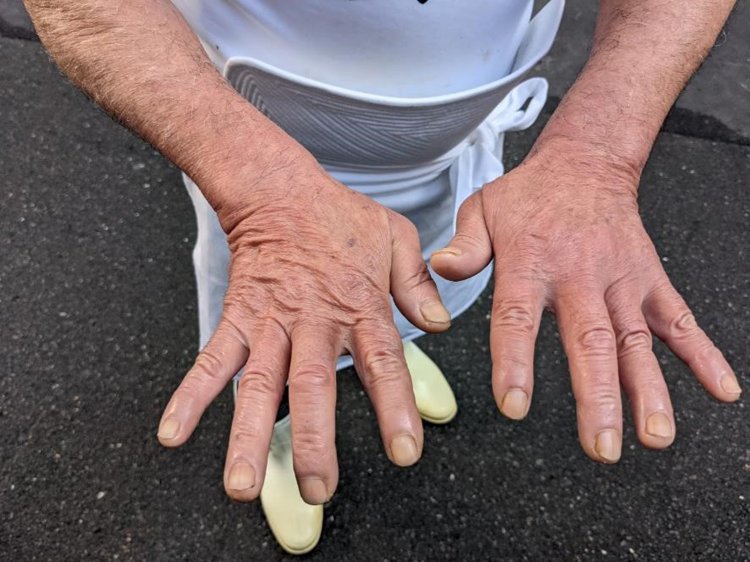 炎の料理人・大将の手。