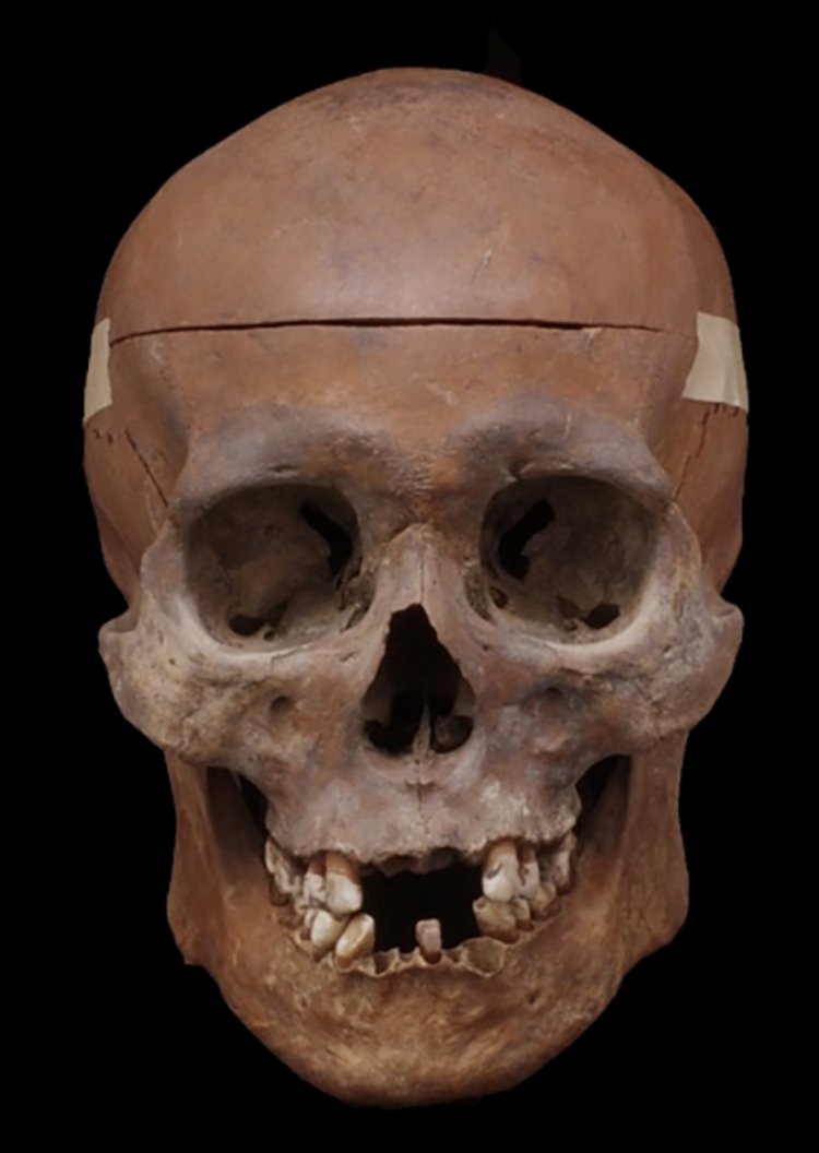 青谷男性頭骨 弥生時代後期（2世紀）鳥取県青谷上寺地遺跡　鳥取県立青谷かみじち史跡公園蔵。