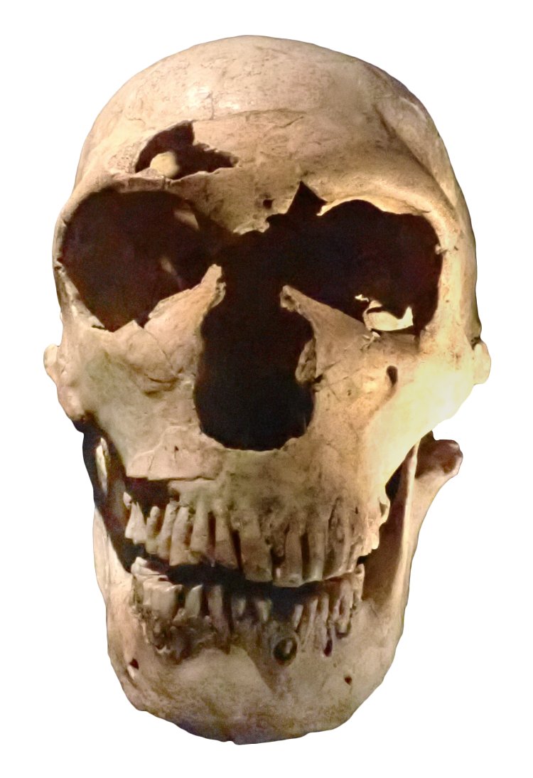 ラ・フェラシー1号(ネアンデルタール人) (C) MNHN。